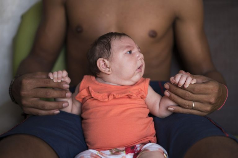 U.S. CDC Study Concludes Zika Can Cause Microcephaly