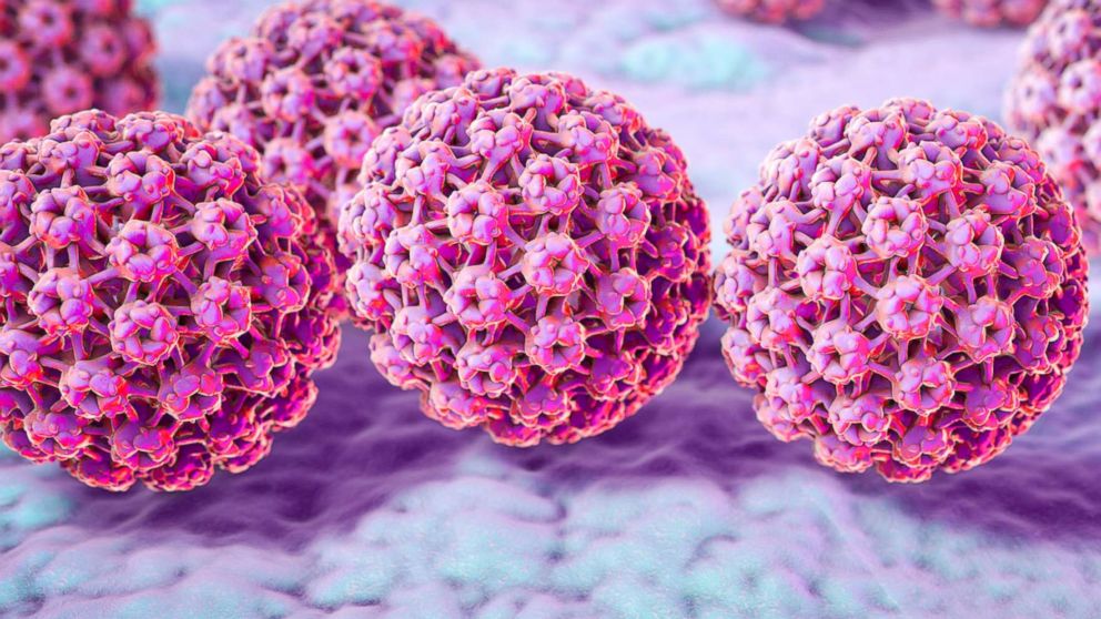 HPV is a disease transmitted by papilloma, a human virus that causes cancers and genital warts, affecting boys and girls. The vaccine is solely administered in adolescence hence the importance of awareness.