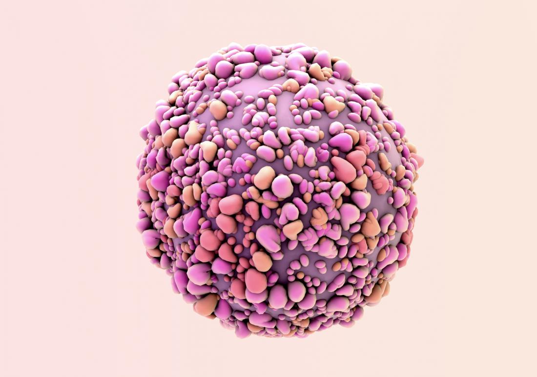 Breast Cancer