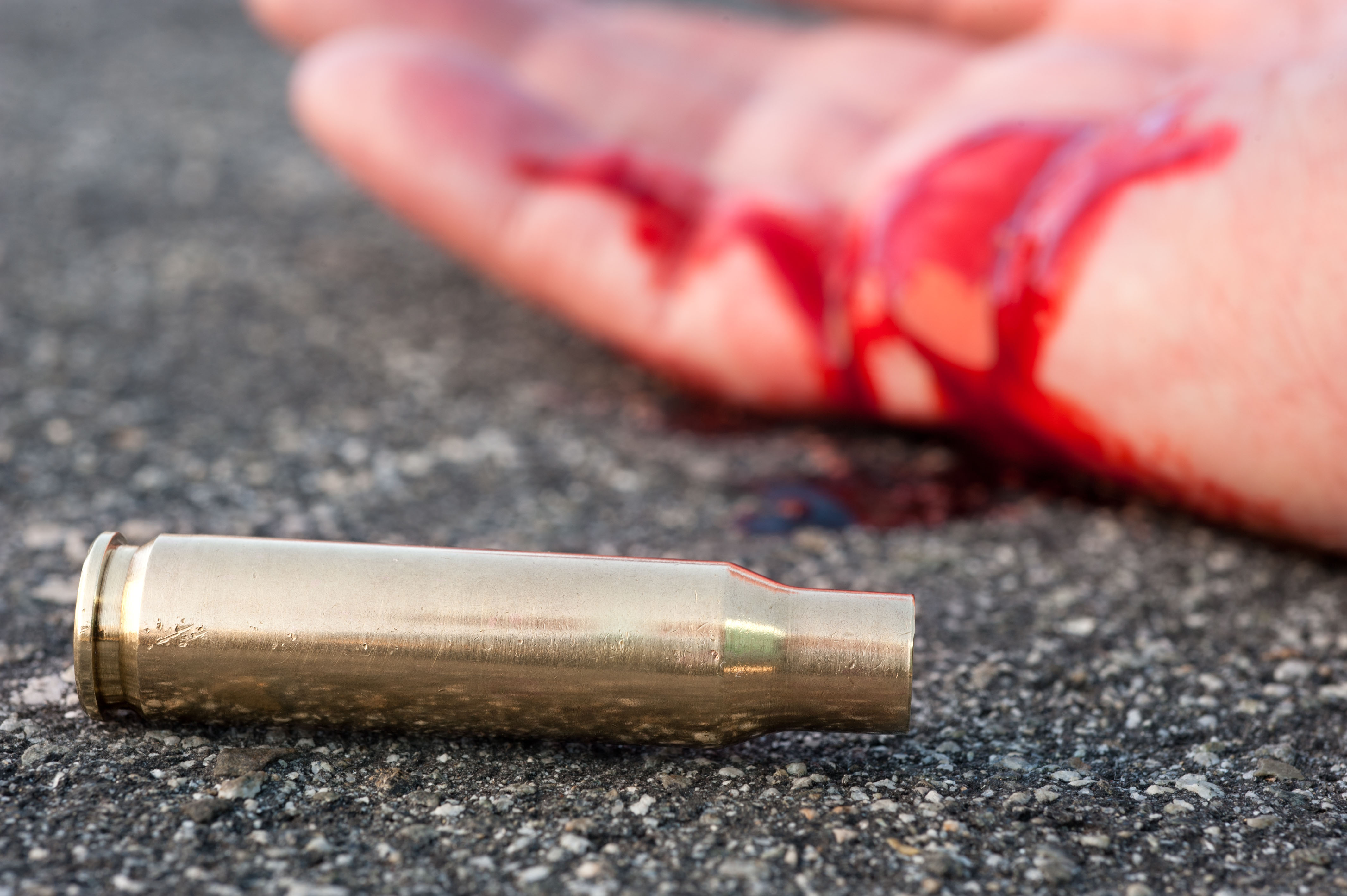 A man shot in the streets with the bullet casing laying next to a bloody hand.