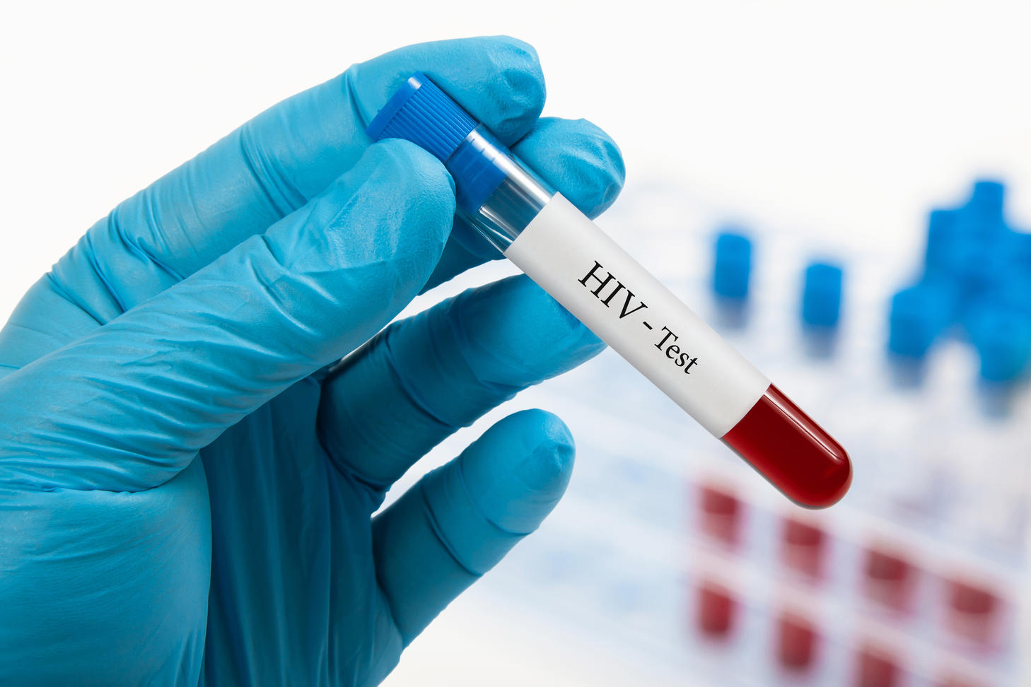 Hand holding blood sample for HIV test