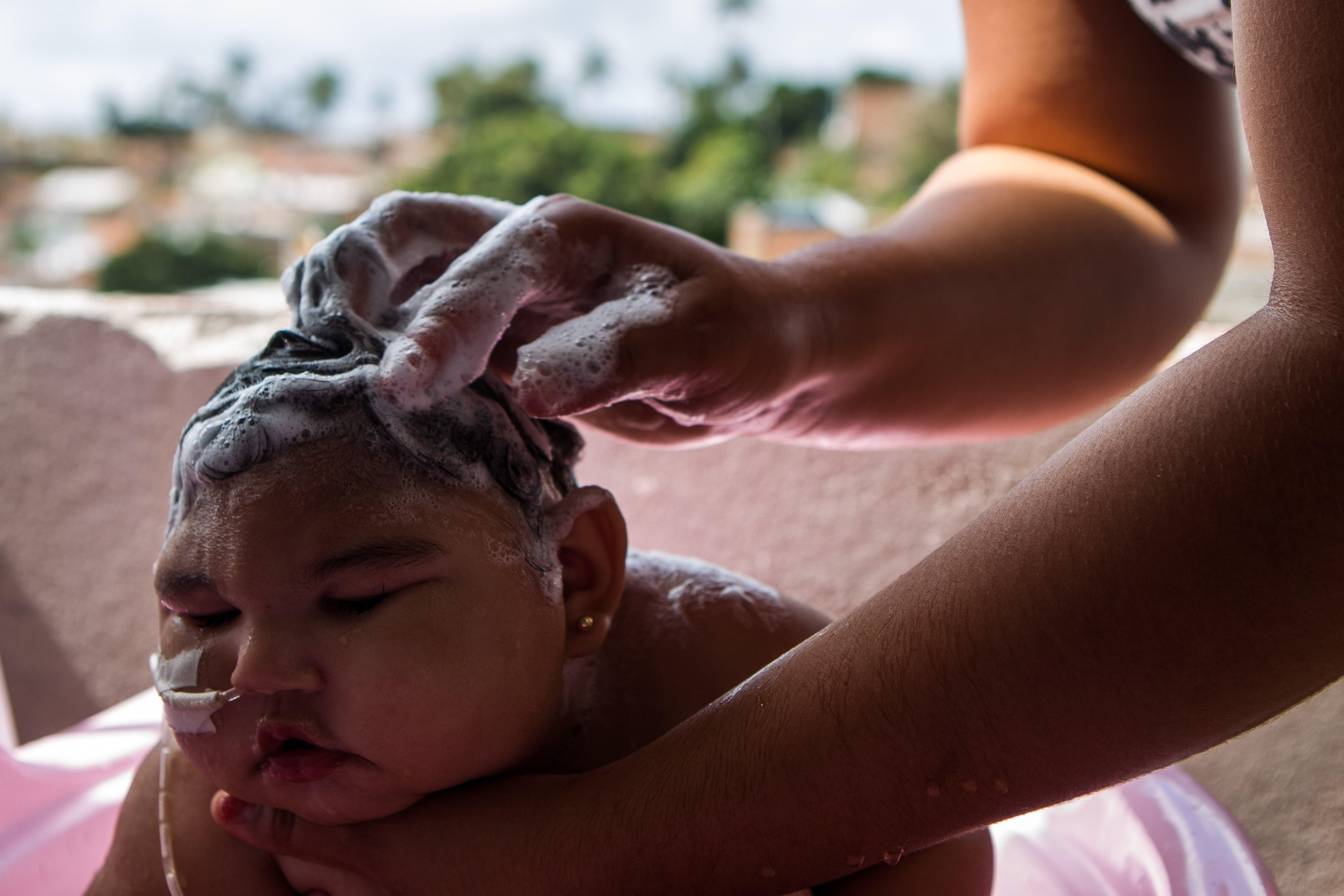 Maria Eduarda nasceu no dia 22/11/2015 de 2015, em Olinda, nordeste do Brasil. Sua mae biologica deu a luz a dez filhos, sendo que nove foram abandonados. Com Maria Eduarda nao foi diferente, sobretudo quando recebeu o diagnostico de microcefalia e os med