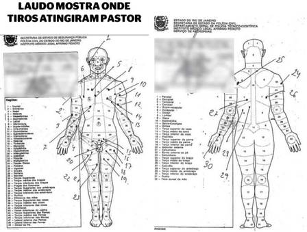 Graphic from Anderson’s autopsy indicating the location of bullet wounds.