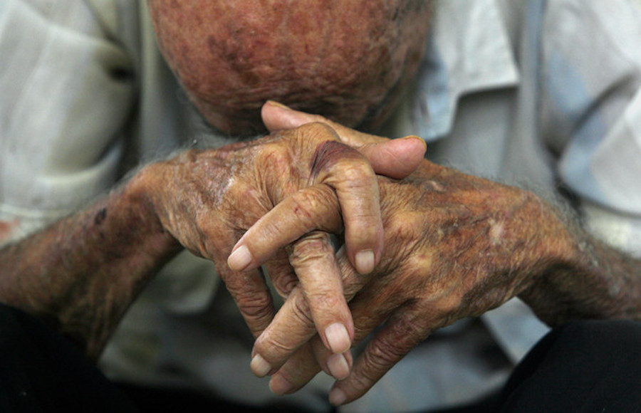 The number of suicides among people over 80 years of age has reached 17.7 for every 100,000 inhabitants, the highest percentage in Latin America.