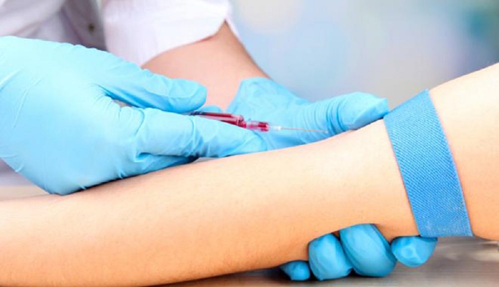 Marcos Espinal, Director of the Department of Communicable Diseases of the Pan American Health Organization (PAHO), said on Tuesday, August 11th, that Brazil still has "a high rate of positives in Covid-19 testing, over 20 percent of the total in some states". In view of this, he said it is "crucial to continue to implement" tests, increasing their availability on national soil. "We must ensure that the tests are widely available to the population," he said.