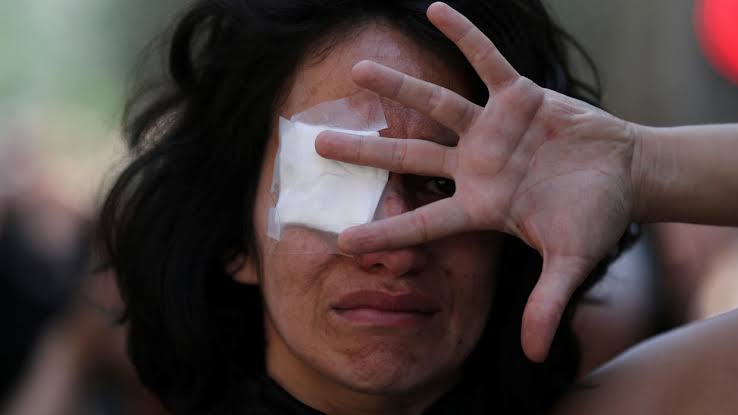 The former model pupil Chile now shows in the crisis that in the last decades not much has changed in the mentality of those in power since the Pinochet era. The country's loss of image is likely to be boundless.