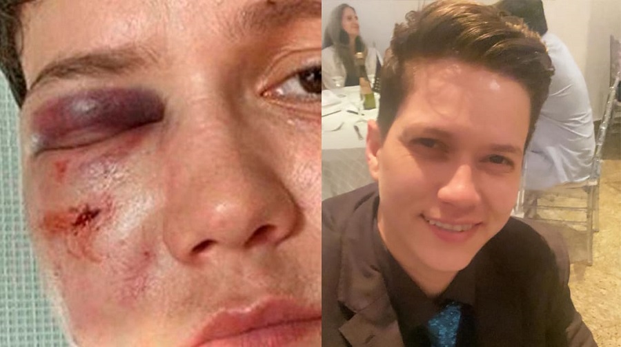 Police Say Karol Eller Started Fight Over Girlfriend, Discards Homophobia