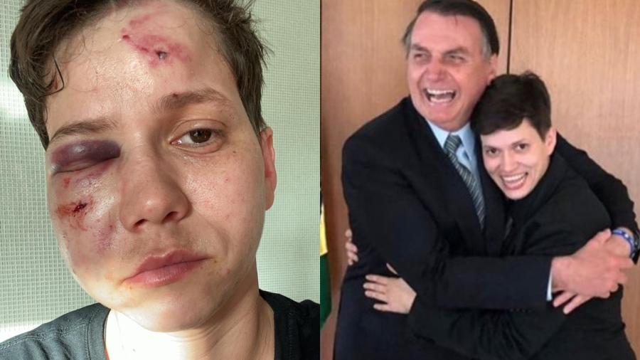 YouTuber Karol Eller, known as a supporter of Bolsonaro's government, was the target of a homophobic attack that left her face disfigured.