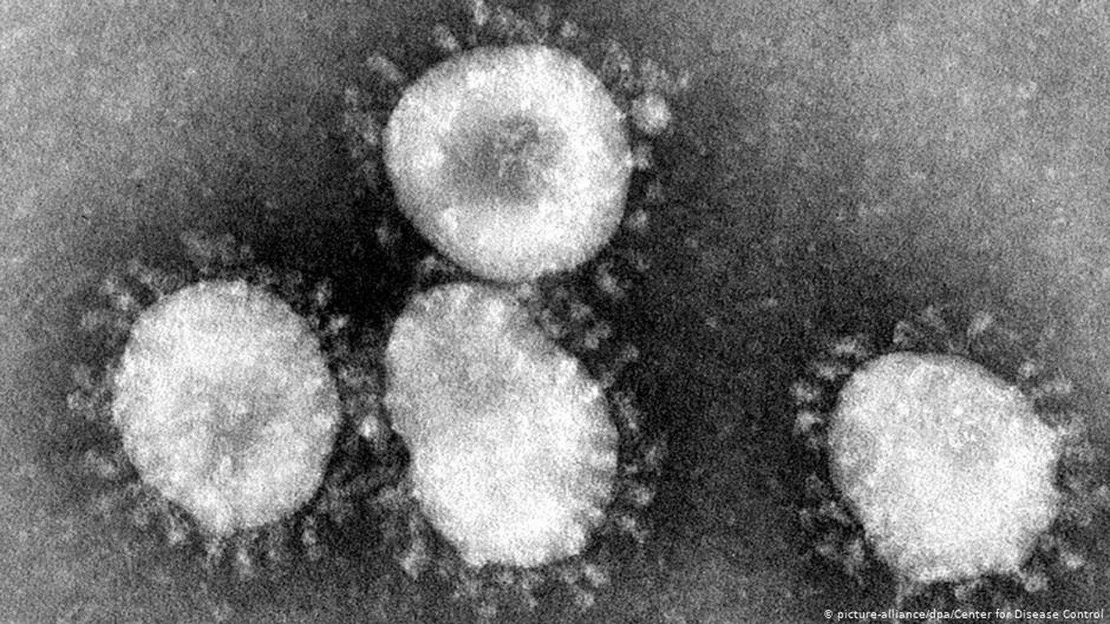 The Ministry of Health reported on Wednesday, March 4th, that it is investigating a potential new confirmed case of the new coronavirus.