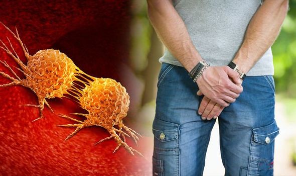 As one ages, the prostate tends to increase in size (it is unknown exactly why) and when it becomes enlarged it may cause health issues.