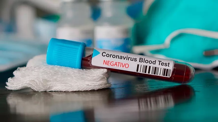 Five people who live in Espírito Santo State and have contracted the Covid-19 are now considered cured, according to information provided by the Health Secretariat of the State.