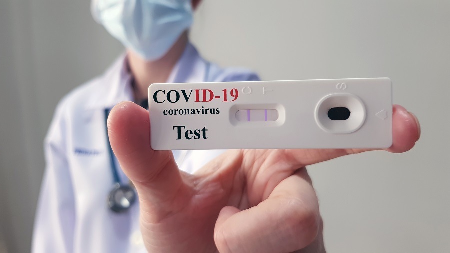 ANVISA Approves Rapid Tests for Covid-19 in Pharmacies, Urges Caution on Results