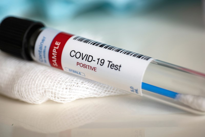 Although the report includes only the number of recorded deaths, the Ministry reports the deaths in its system on the day they occurred after tests have confirmed the disease.