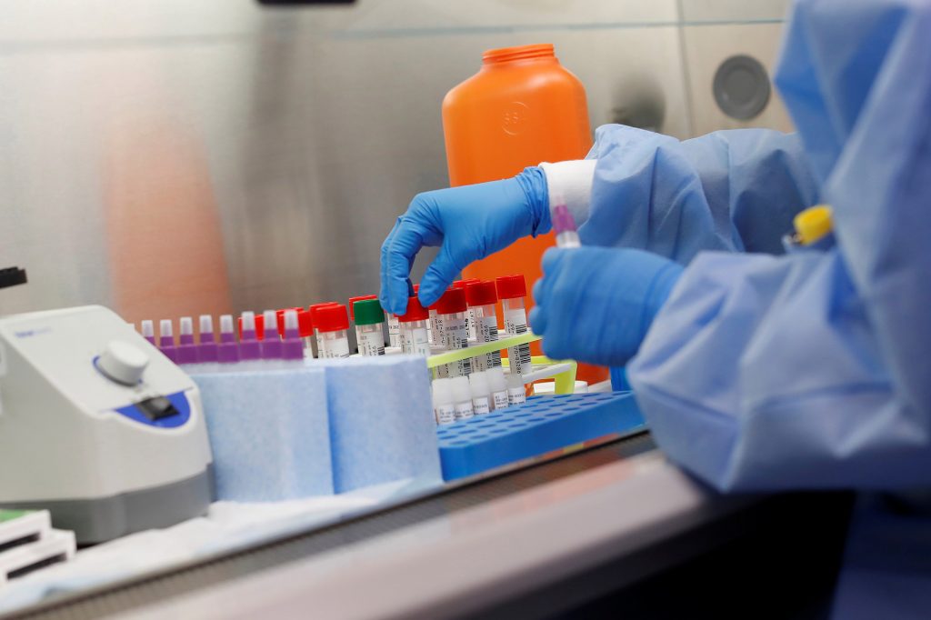According to the researchers, the new test, 100 percent Brazilian, should cost approximately R$40 (US$8), half the price of the products on the market - currently, all are imported.