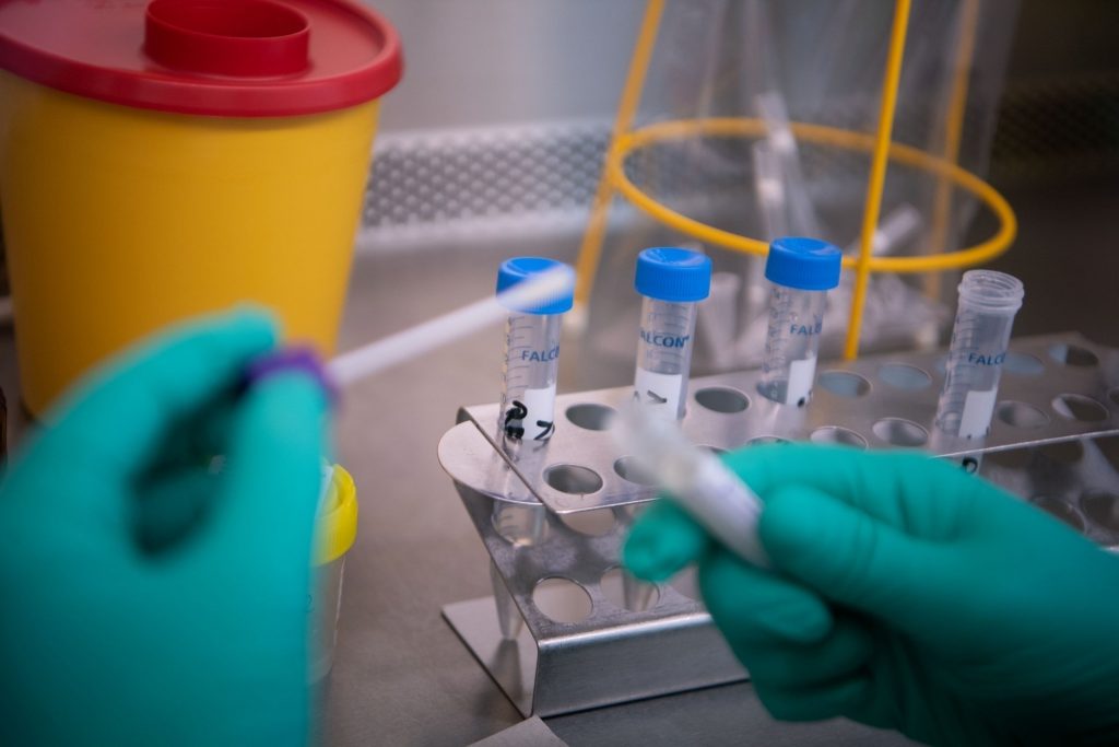 In São Paulo, the backlog of people waiting for the result amounts to 12,000 patients, according to José Henrique Germann, the state's secretary of health.