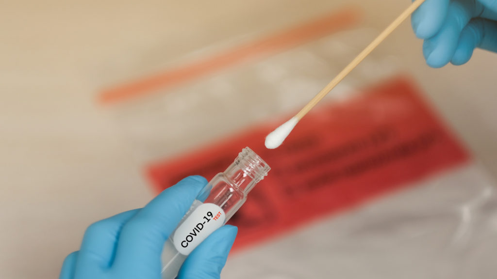 The main reason for the tests to be stranded on the Ministry's shelves is the lack of supplies used in laboratories to process patients' samples.