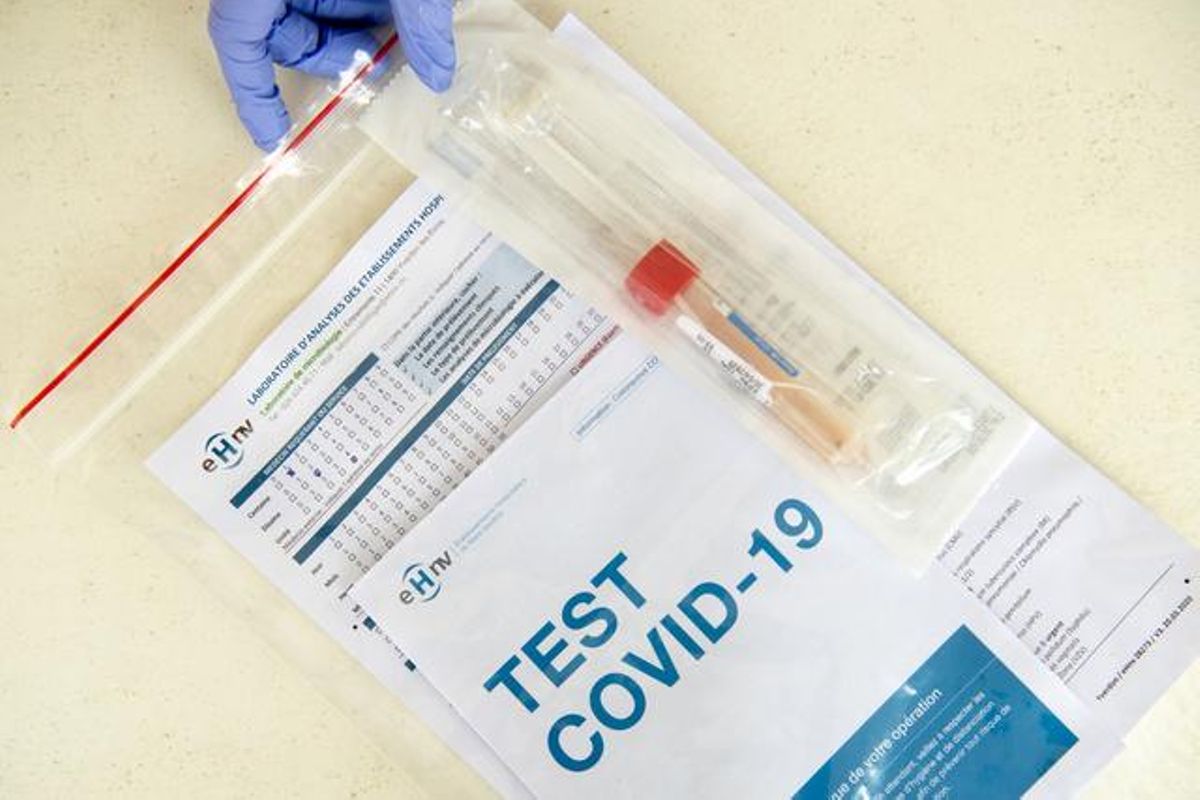 The test identifies the presence of IgA, IgG, or IgM antibodies in the blood of patients exposed to the virus.