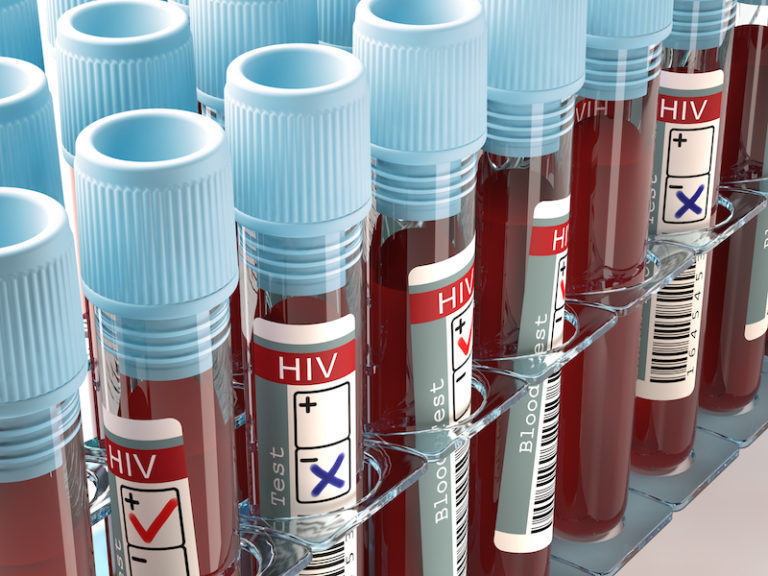Brazilian Researcher Claims He Has Eliminated HIV from Patient Using New Cocktail