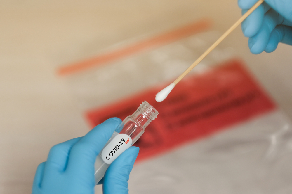 The RT-PCR is a molecular test that detects the presence of the virus' genetic material. That is, it diagnoses active infections. The test is performed by collecting material with a swab, inserted in the nose or the back of the throat.