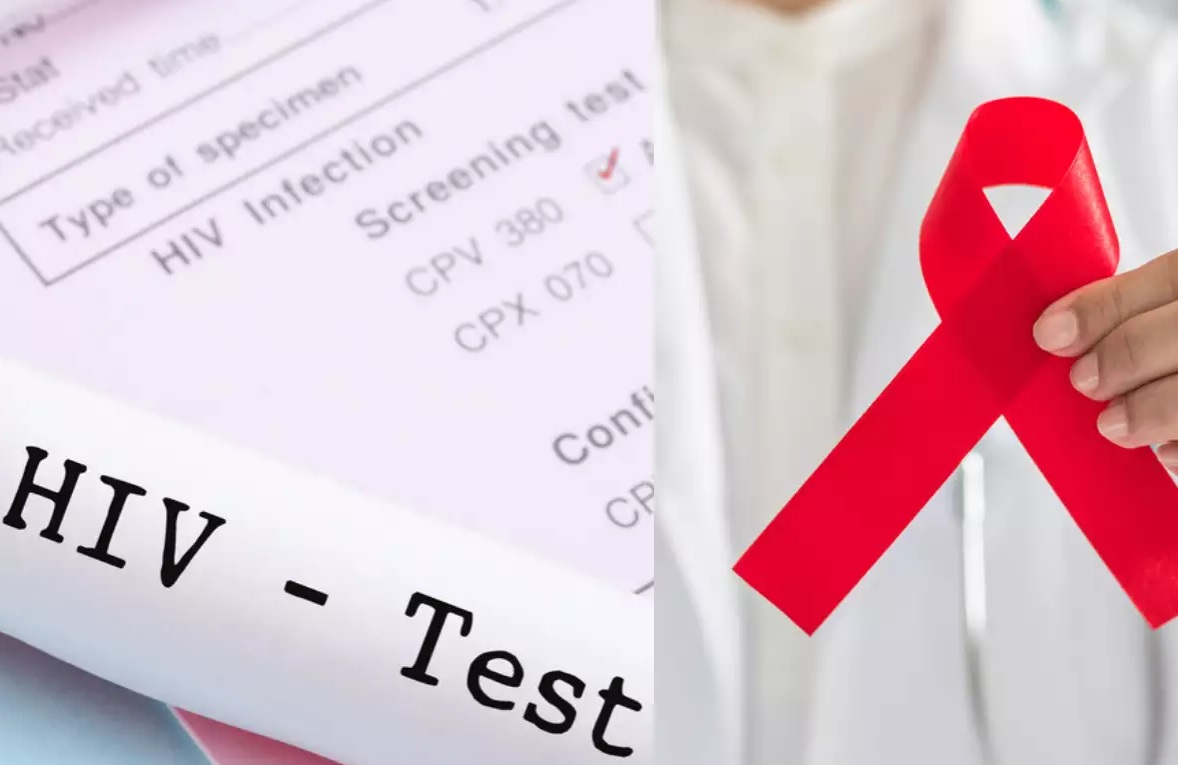 hiv-patient