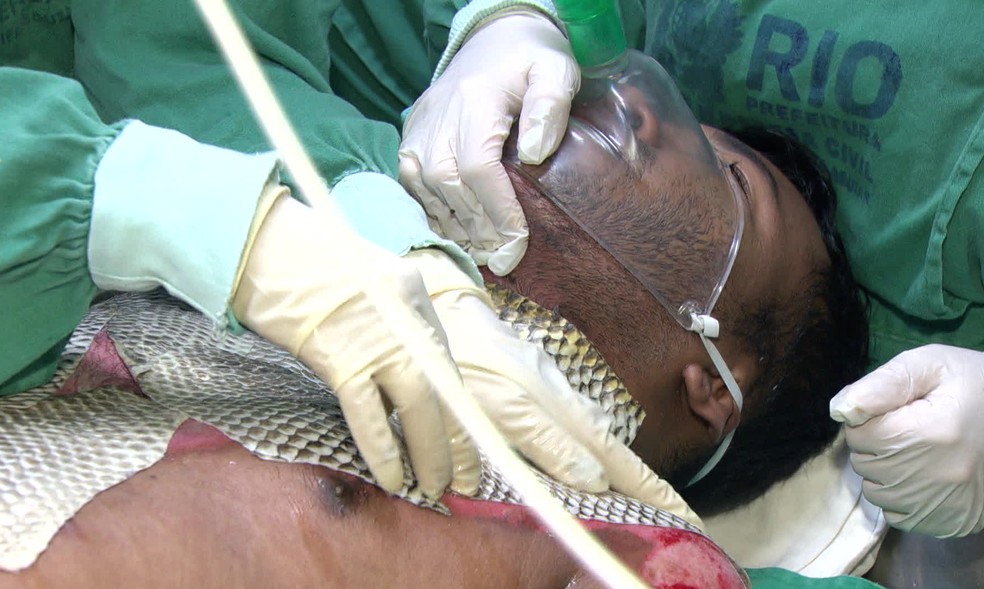 Clinical studies conducted on over 350 patients have shown that tilapia skin has a high regenerative potential, reduces pain in patients, and reduces dressing changes and clinical operating costs.
