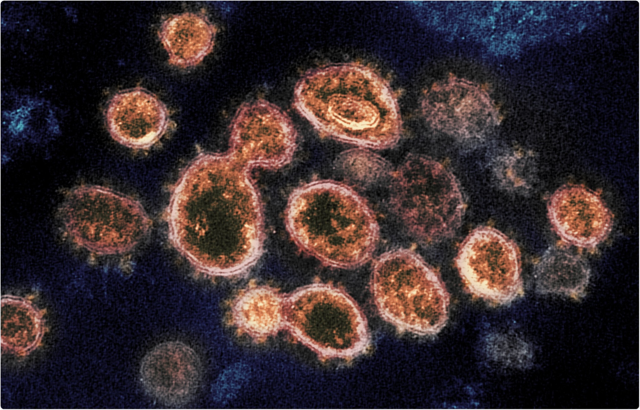 European scientists have detected a new strain of SARS-CoV-2, the virus that causes Covid-19, which has been rapidly spreading across Europe since June and is now the cause of most of the cases observed in the second wave of infections in some countries on the continent.
