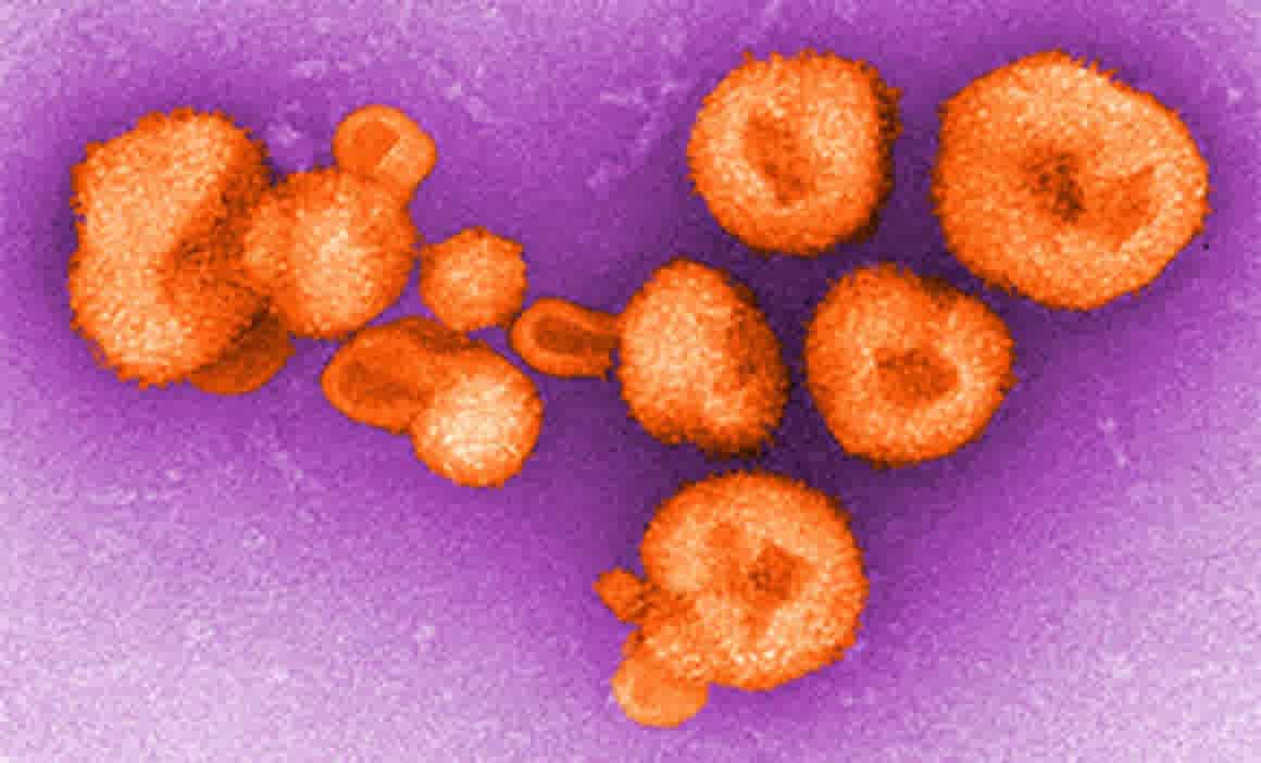 virus