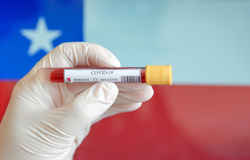 The Chilean Ministry of Health reported on Saturday 2,564 new cases of the novel coronavirus (COVID-19) in the last 24 hours, the highest daily number since July, which occurred amid a 37 percent rise in infections nationwide over the past two weeks.