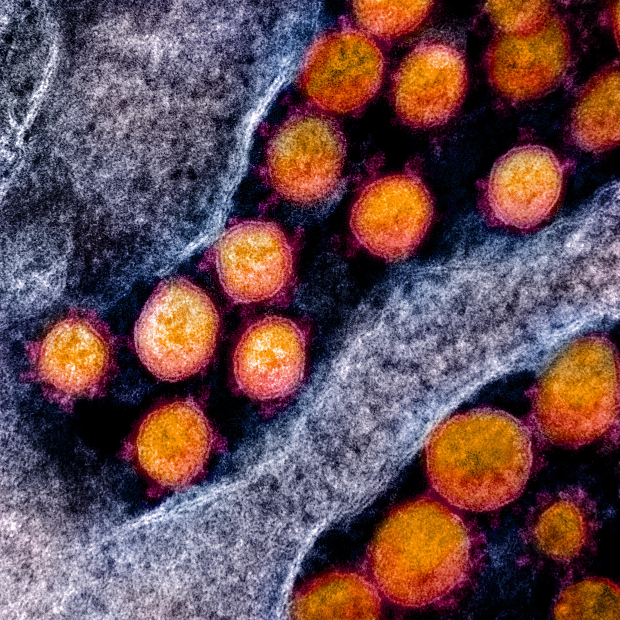 Covid Reinfection