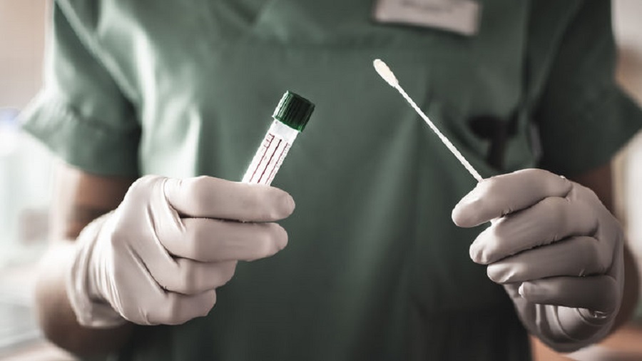 Argentina heading toward second wave with less testing per million inhabitants than Cuba