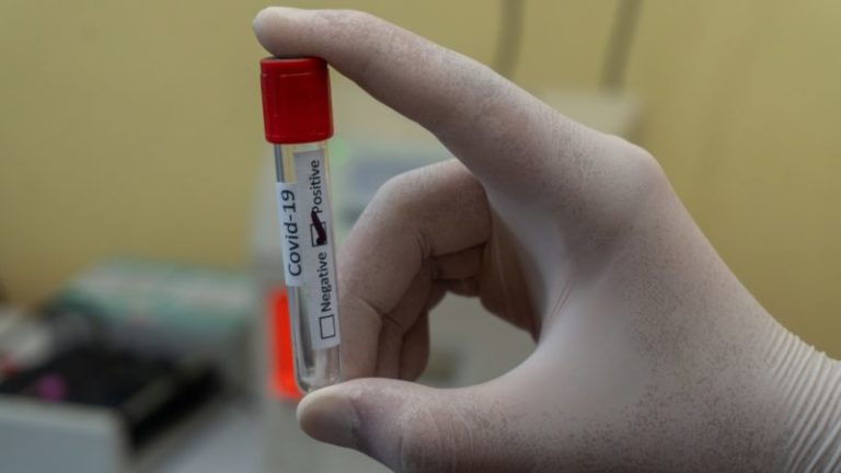 Brazil’s health regulator authorizes Butantan to conduct human trials for anti-Covid serum