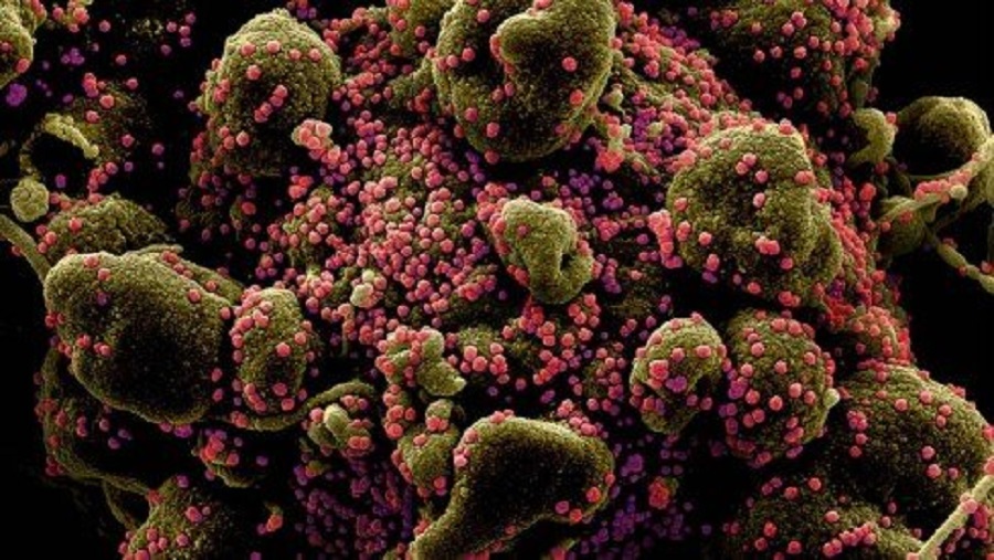 New coronavirus variant detected in Rio de Janeiro state