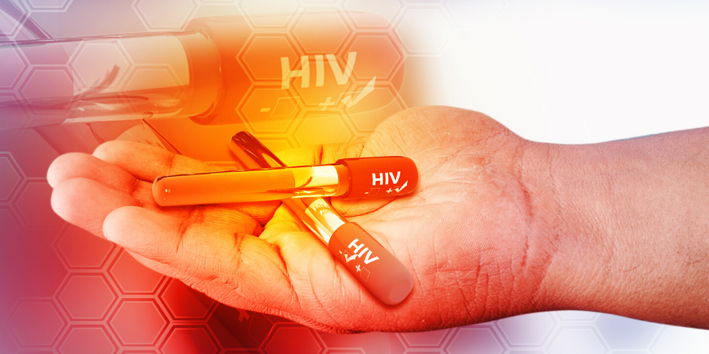 Brazilian study to cure HIV will resume by the end of the year