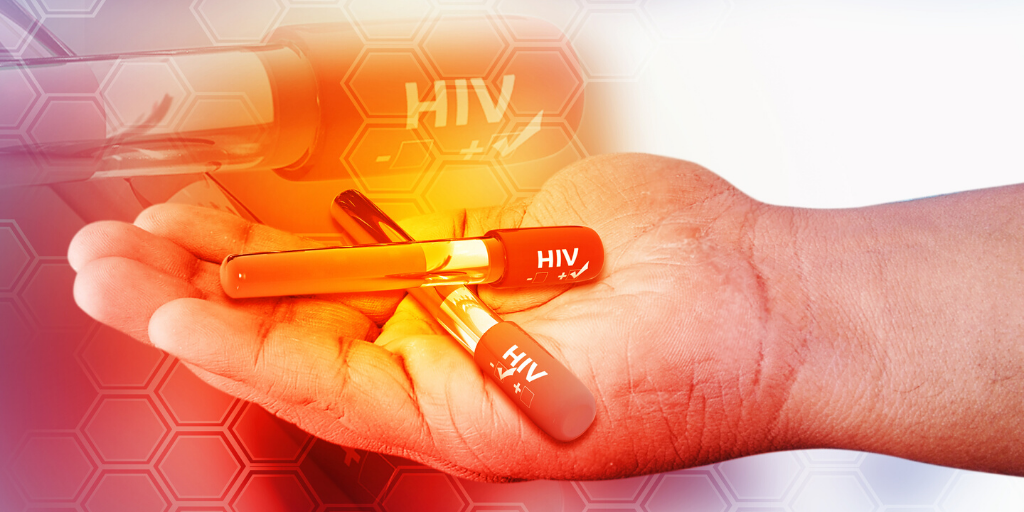 HIV-Featured-Article