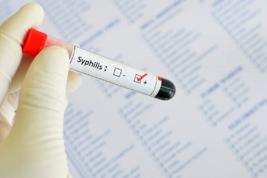 Syphilis cases up again in Brazil; know the risks