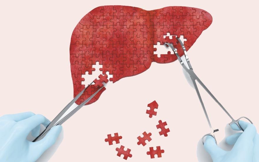 Although it can be split, there is a minimum volume of the liver that the person needs to receive to stay alive. It varies according to the receiver's weight. According to Pacheco, the minimum is 0.8% of body weight. For example, a person who weighs 100 kg has to receive 800 g of the liver.