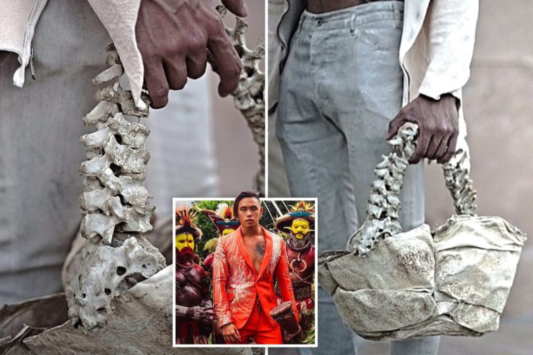 Brazil investigates human organs trafficking for fashion designer