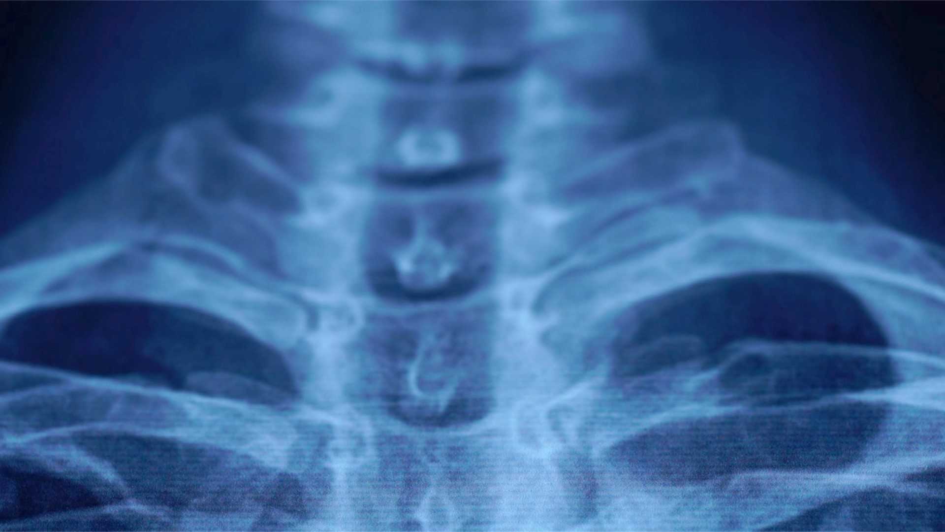 xray