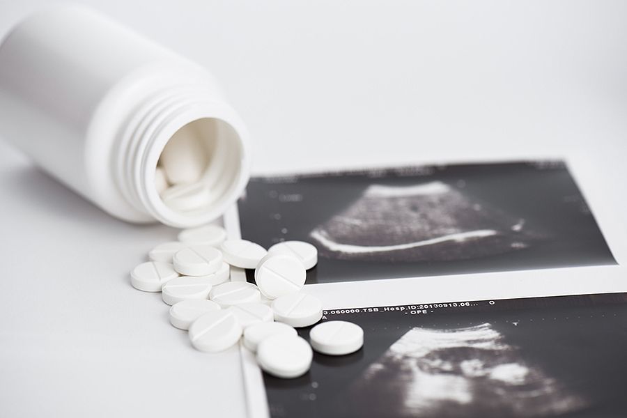 abortion-legal
