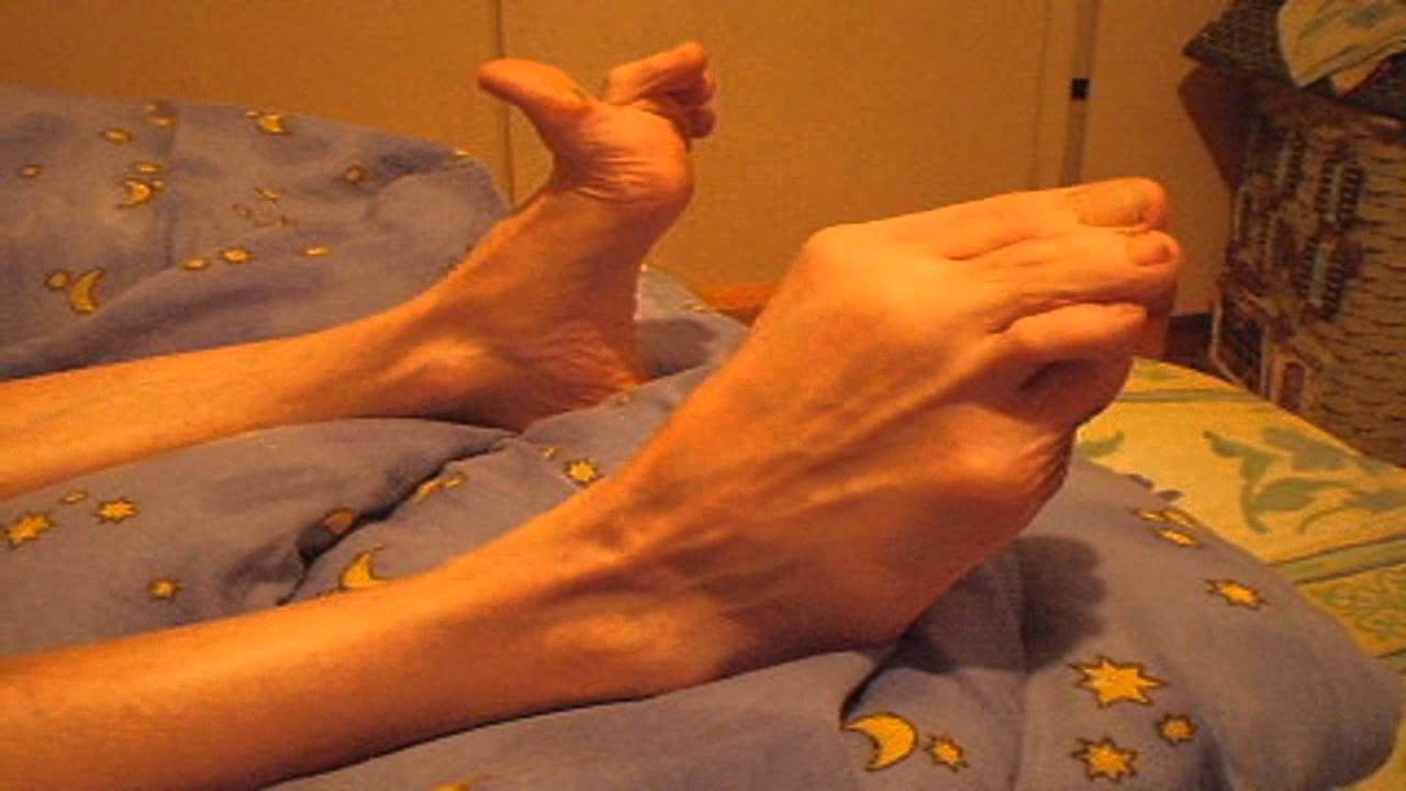 Guillain-Barré syndrome