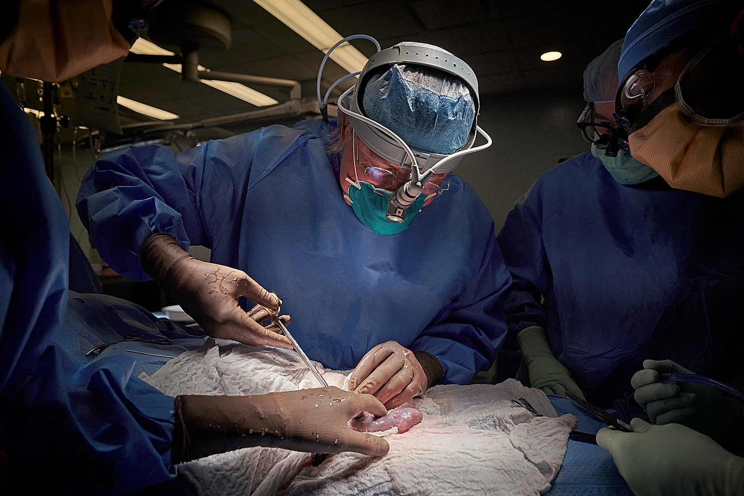 Organ Transplant Breakthrough: Human Receives Gene-Edited Pig Liver. (Photo Internet reproduction)