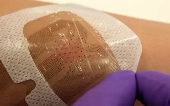 Smart Bandages: The Future of Healing Wounds