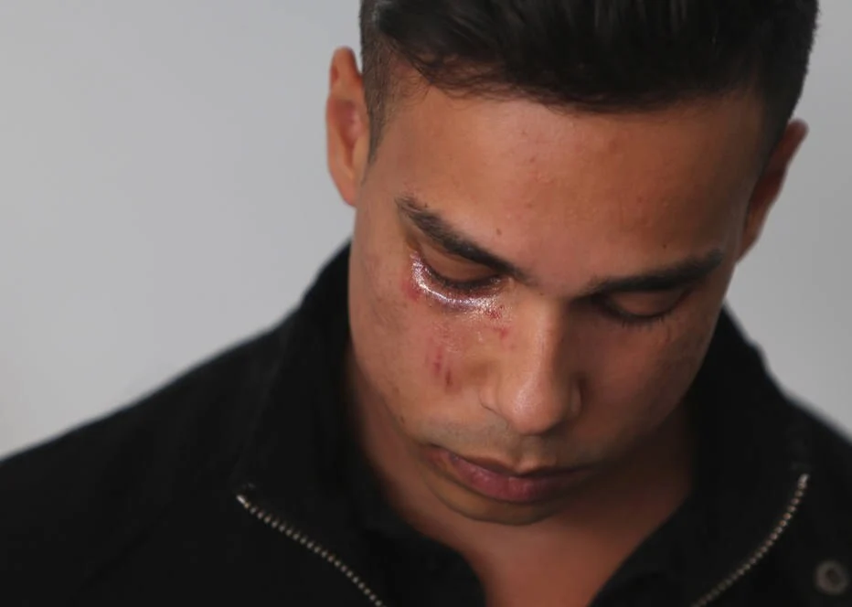 Violence Against LGBTQIA+ in São Paulo Rises 970% in Eight Years. (Photo Internet reproduction)