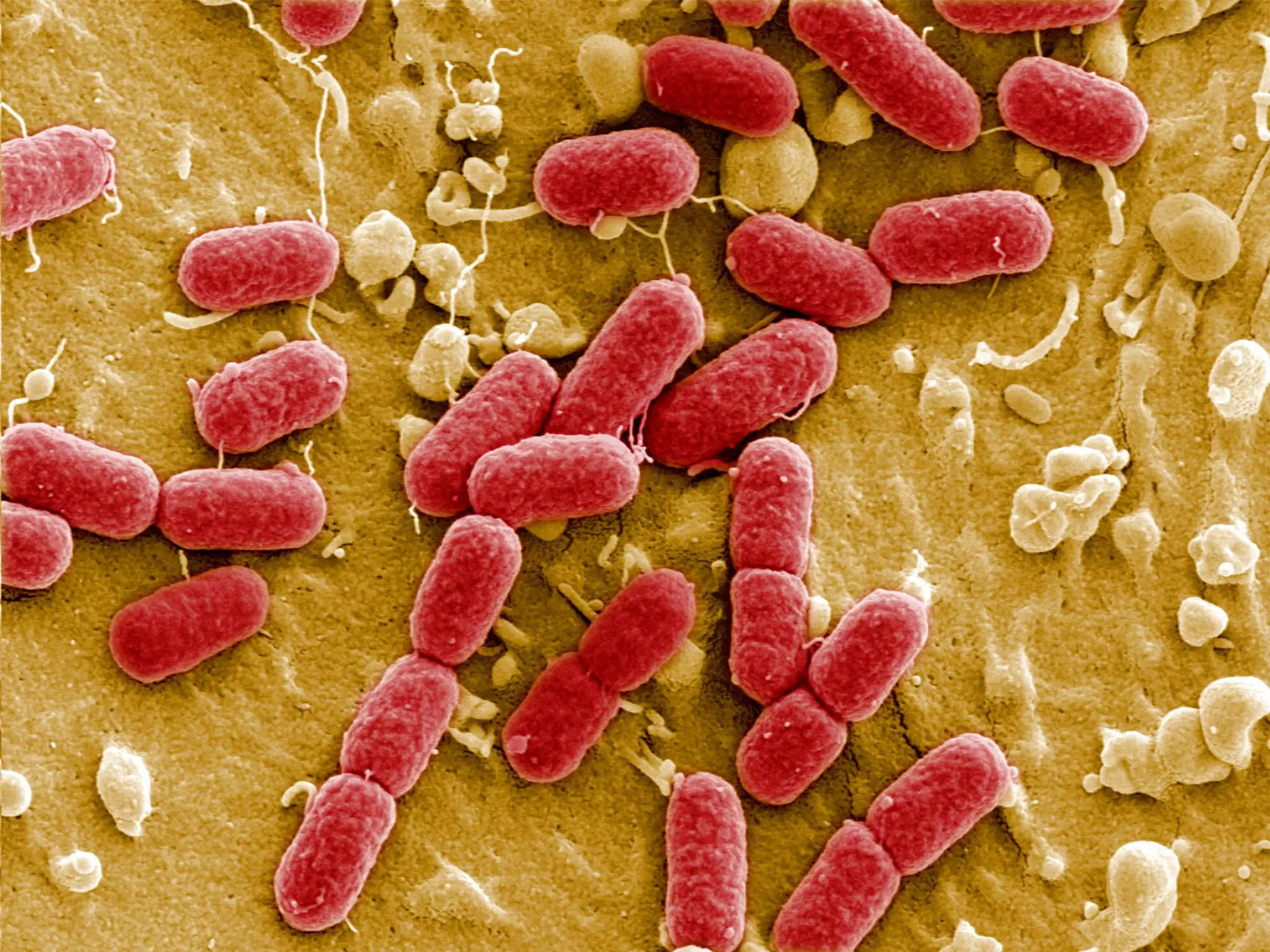 Innovative Antibiotic Tackles Global Superbug Threat