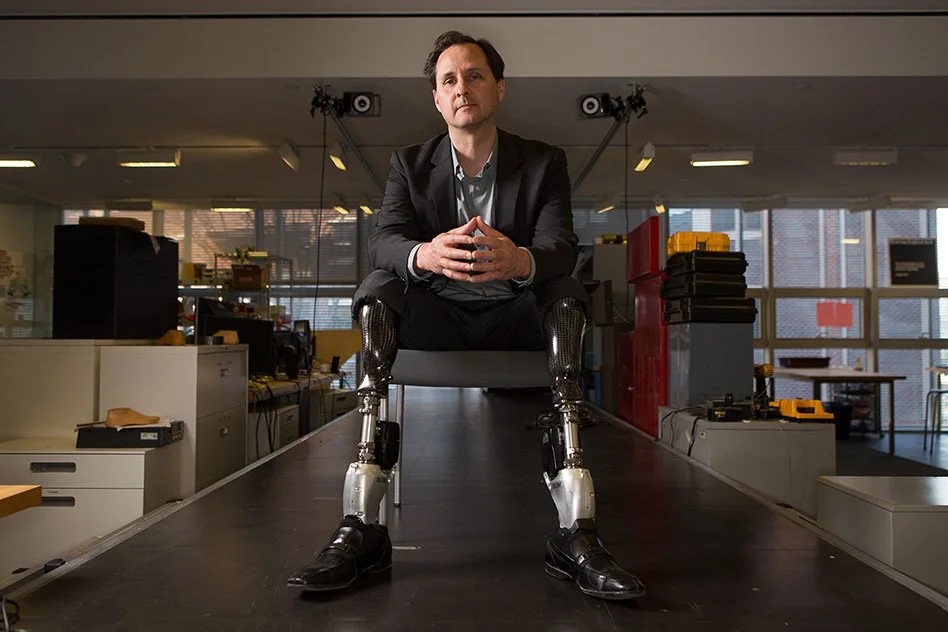 Bionic Breakthroughs: Enhancing Mobility for Amputees