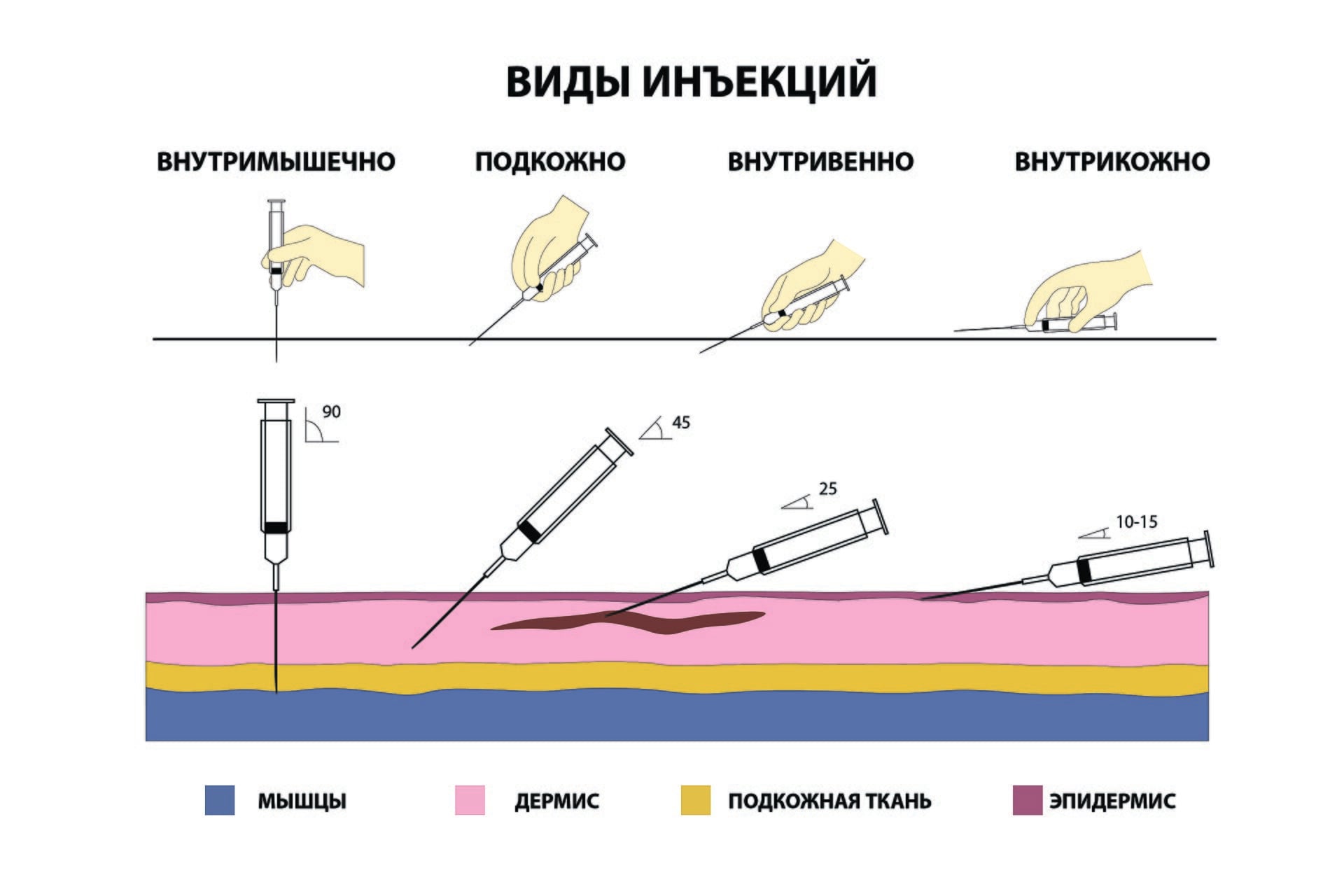 A subcutaneous medical injection