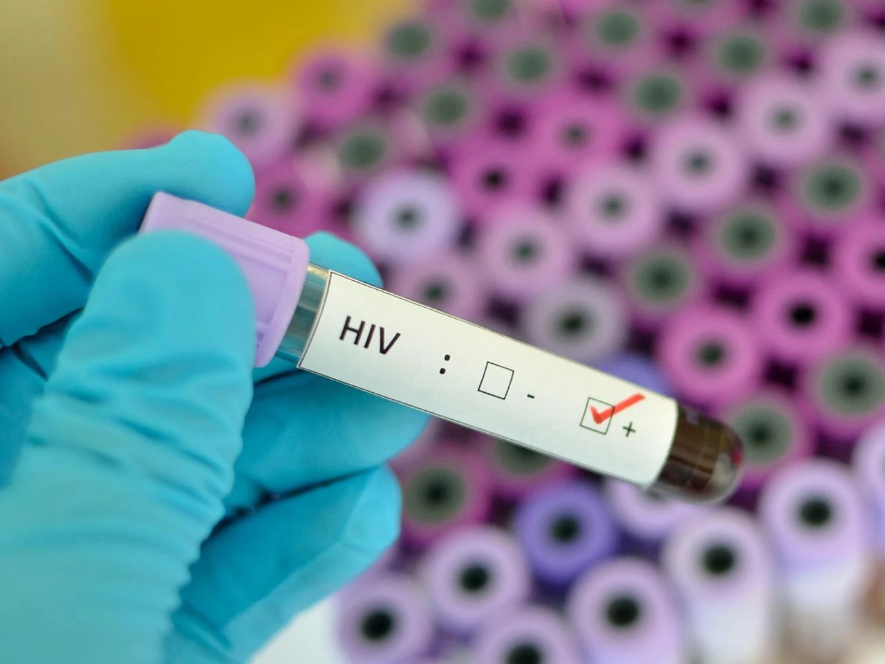 hiv112